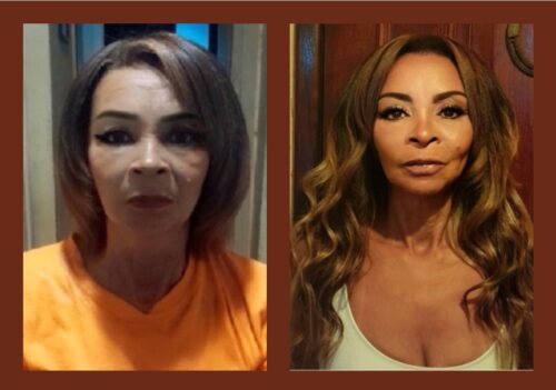 Colocação Mega hair