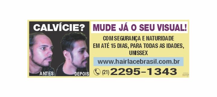 Calvície? Mude já o seu visual!