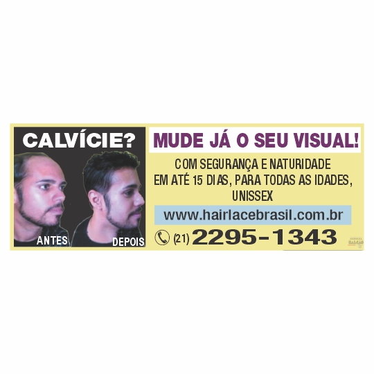 Calvície? Mude já o seu visual!