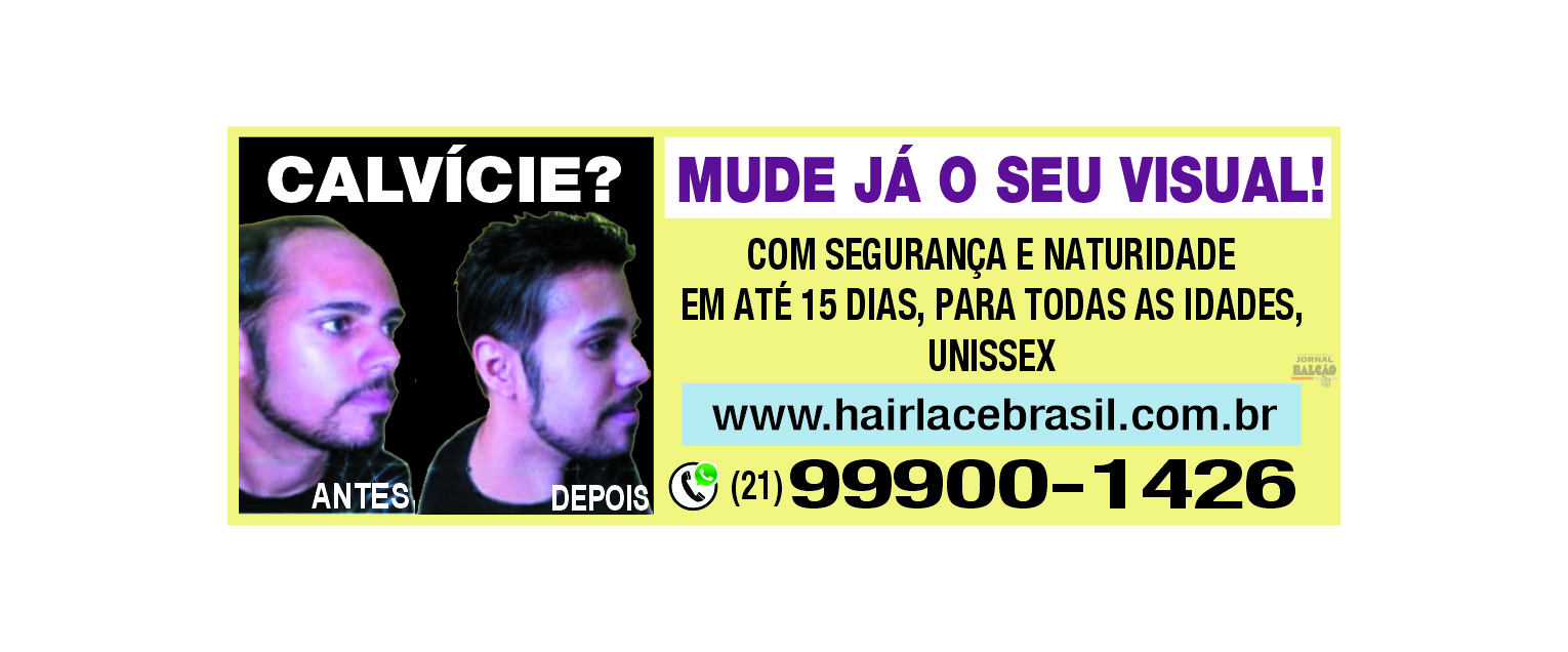 Calvície? Mude já o seu visual!